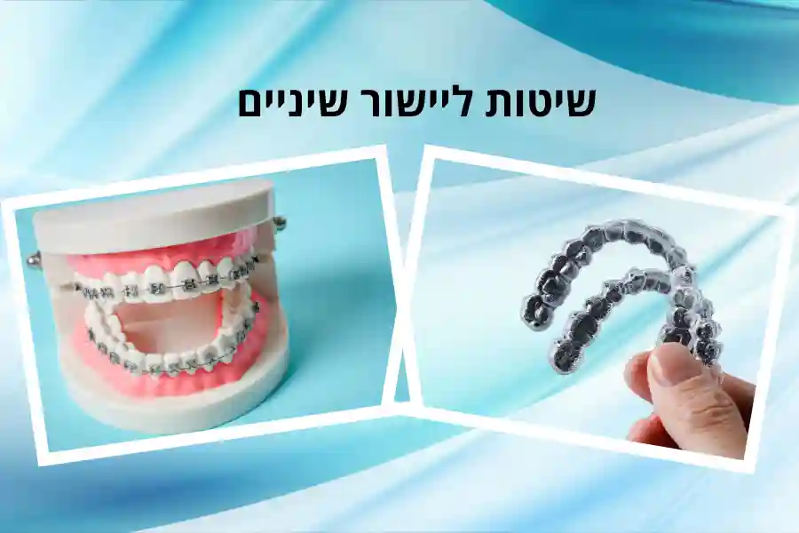 שיטות ליישור שיניים